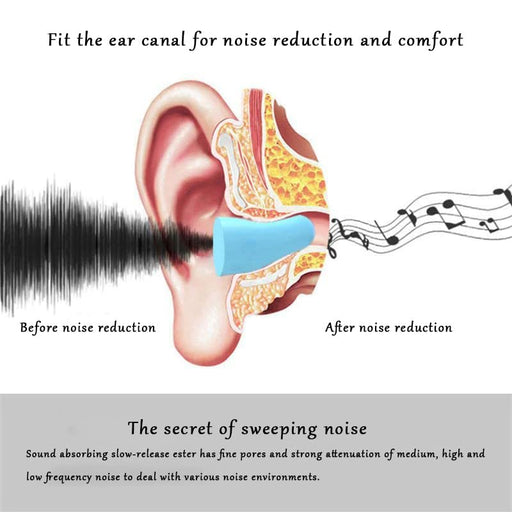 Easy-to-use soundproof sleeping ear plugs, simply insert and enjoy a peaceful night's sleep